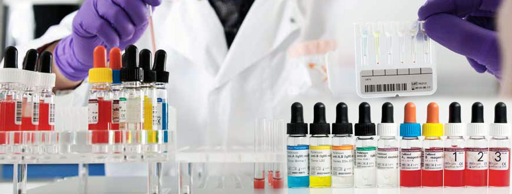 Alura med — reagensi za biohemiju